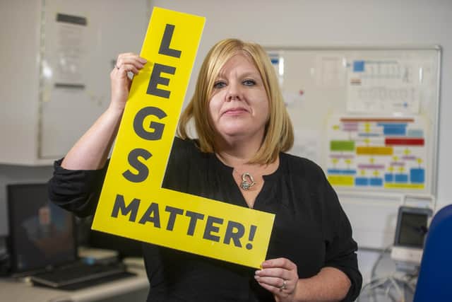 Dr Leanne Atkin, vascular nurse consultant at Pinderfield Hospital, is trying to raise awareness with the Legs Matter campaign of how poor-quality healthcare for leg and foot conditions is leading to limb amputations which could have been avoided. Picture Tony Johnson