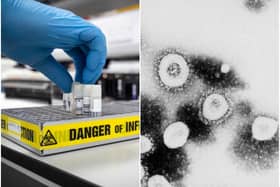 Five people in the UK have died after testing positive for coronavirus.