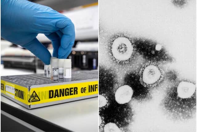 Five people in the UK have died after testing positive for coronavirus.