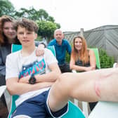 Oscar and family in 2016 after he was hurt by giant hogweed.