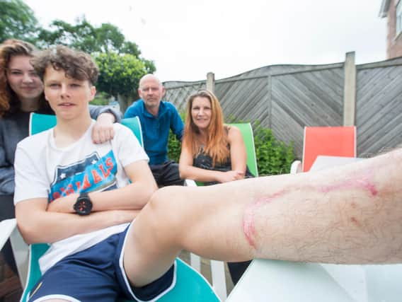 Oscar and family in 2016 after he was hurt by giant hogweed.