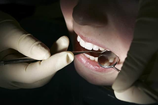 Thousands of callers to NHS 111 in Yorkshire and the Humber required dental treatment last month, as dentists remain closed from the coronavirus lockdown.