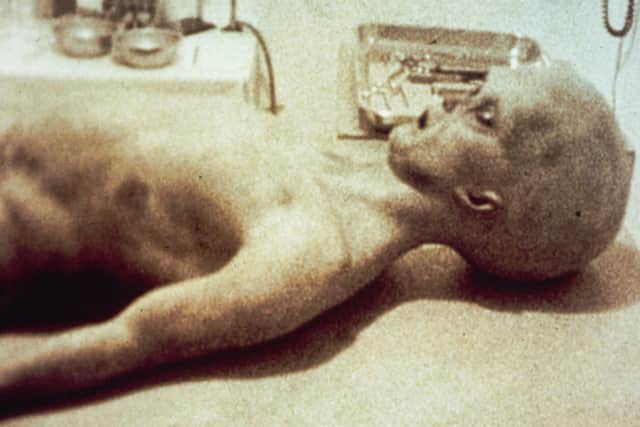 Still from Alien Autopsy video