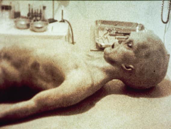 Still from Alien Autopsy video