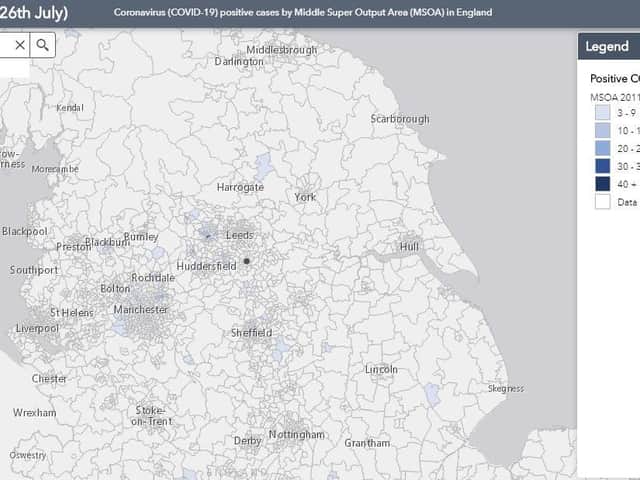 The postcode tool from Public Health England, allows you to see how many cases are in your area as well as the surrounding areas