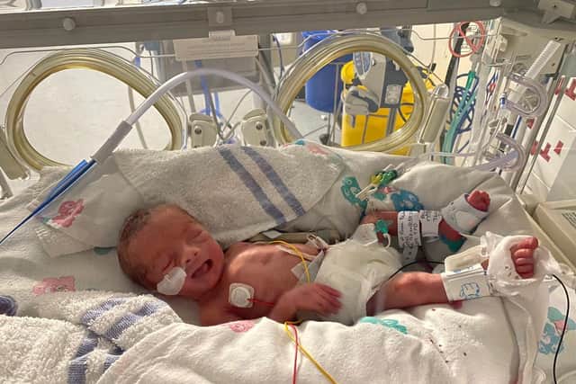Baby Archie was born prematurely at 30 weeks and used life saving equipment to go from strength to strength.