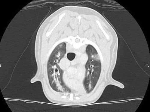 A CT scan showing the lungworm infection