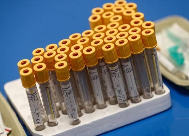 A University of Oxford study published today outlines a new type of blood test that can be used to detect a range of cancers and whether these cancers have spread in the body.