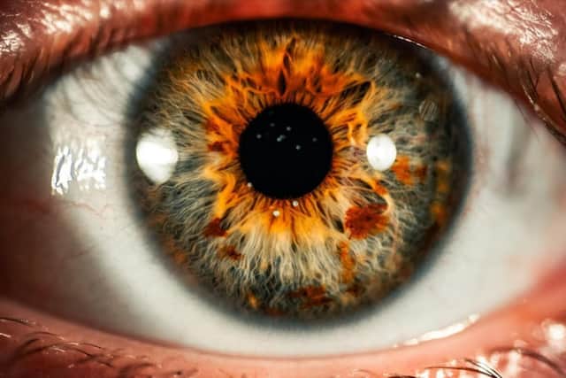 Dr Nigel Best, an optometrist at Specsavers, is urging people not to take part in these trends which sees them exposing their eyes to bright lights and toxic substances.