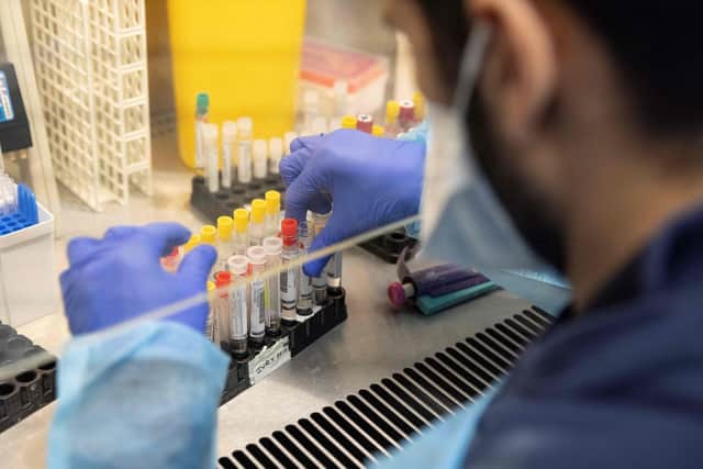 On Monday, the Government announced its Living with Covi-19 strategy - meaning all domestic restrictions will end on February 24.