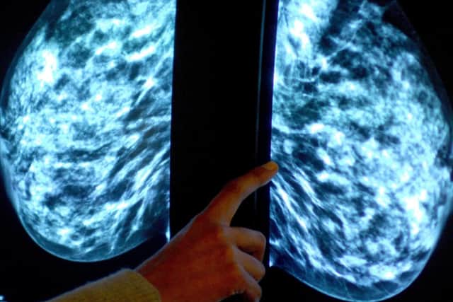An "alarming" drop in breast cancer screenings across England is a reminder of the devastating impact Covid-19 has had on cancer care and diagnosis, charities say.
