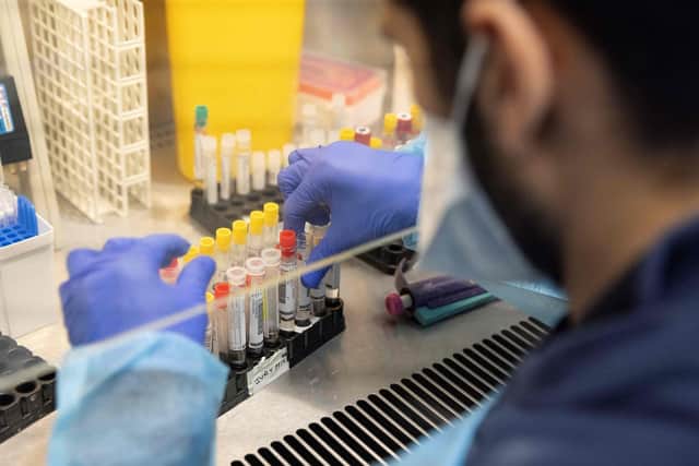 Nine new symptoms of Covid have been added to the official NHS list as the number of people with the virus has reached record highs.
