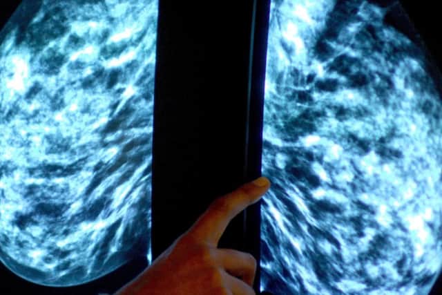As Breast Cancer Awareness Month approaches this October, experts are urging women across the UK to check for signs and symptoms of the disease and for those eligible to take up their invitations for routine screenings.