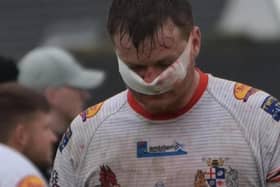 Eastmoor Dragons player Jordan Walker is bloodied during the match with Walton and Crofton Sports. Picture: MKS Photography