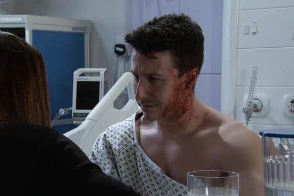Ryan was left with severe burns after evil Justin Rutherford threw acid at him (Photo: ITV)