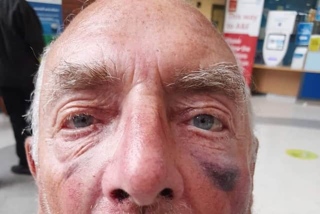 Kenneth Wade was brutally attacked on Monday in Thornes Park.