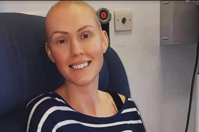 Joanne lost her hair and eyebrows during treatment.