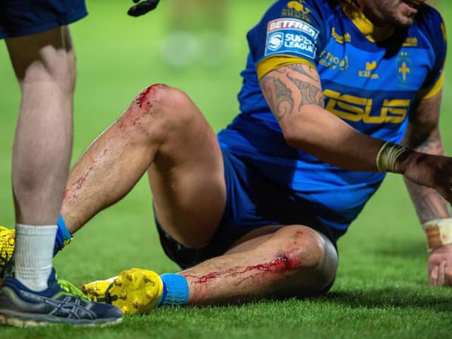 Kevin Proctor's knees at the end of Wakefield Trinity's game against Huddersfield Giants. Picture: Bruce Rollinson