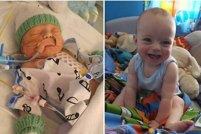 Evan Massheder underwent open heart surgery when he was just 14 hours old. He is now a healthy child.