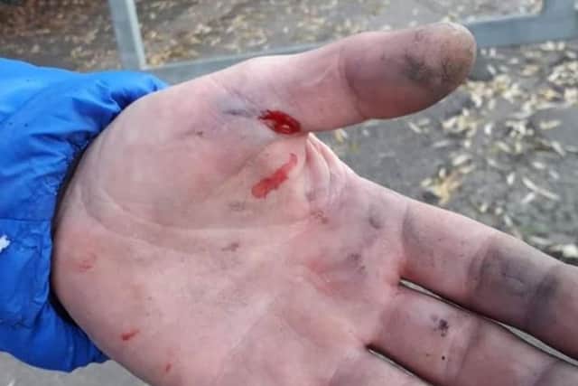 The man recieved a hand injury from the unexploded firework.