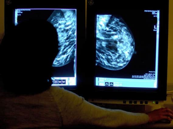 It was revealed in February that the local NHS was struggling to see patients referred for a breast cancer scan quickly enough.