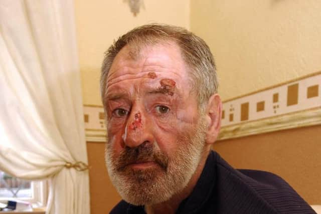 An ageing Paul Sykes battled with alcoholism in his later years.
