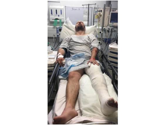 The family of a hit-and-run victim are calling for witnesses after a cyclist was left with horrendous injuries.