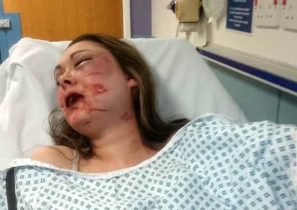 Stephanie was left with horrific facial injuries after being brutally beaten by her partner.
